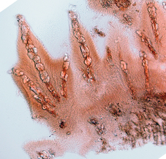 Phlebia subfascicularis