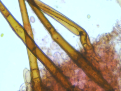 Scutellinia patagonica