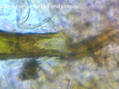 Scutellinia patagonica