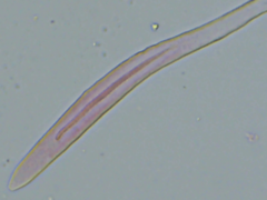 Coccomyces triangularis