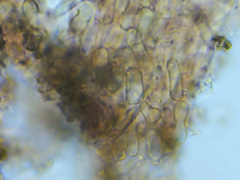 Coccomyces triangularis