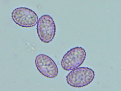 Scutellinia patagonica