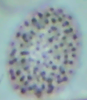 Scutellinia patagonica