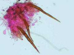 Scutellinia patagonica