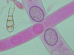 Scutellinia patagonica