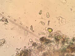 Rhizocarpon reductum