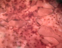 Coprinopsis clastophylla