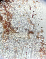 Coprinopsis clastophylla