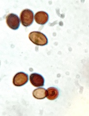 Coprinopsis clastophylla