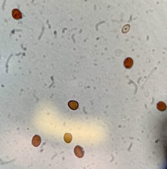 Coprinopsis clastophylla