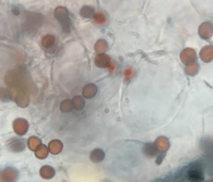 Coprinopsis clastophylla