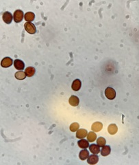 Coprinopsis clastophylla