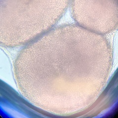 Coprinopsis clastophylla