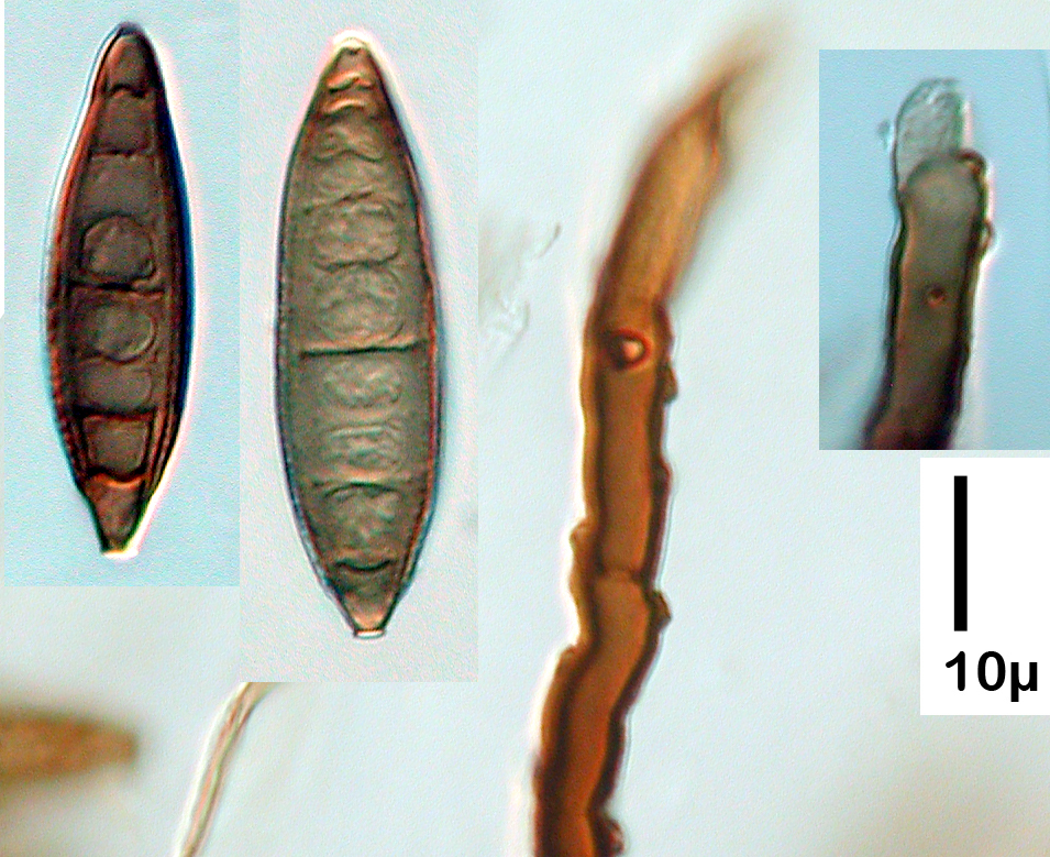 Pseudospiropes simplex