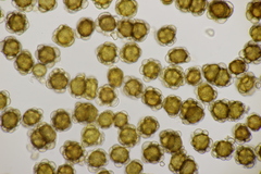 Urocystis agropyri