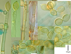 Botryobasidium aureum