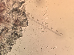 Micarea neostipitata