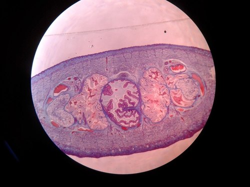 Hirudo medicinalis