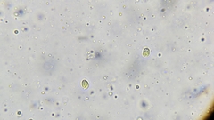 Pseudoomphalina