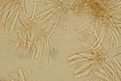 Sclerotinia
