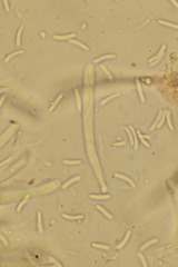 Sclerotinia
