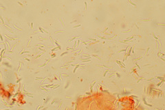 Sclerotinia