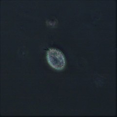 Euglypha