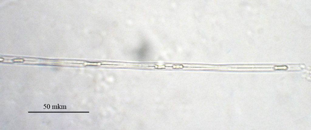 Pseudo-nitzschia delicatissima