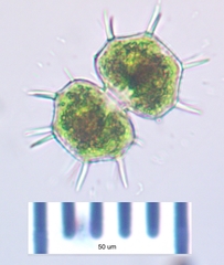 Xanthidium cristatum