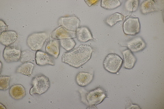 Puccinia pulverulenta