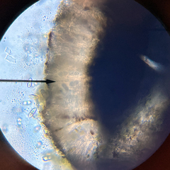 Rhizocarpon hochstetteri