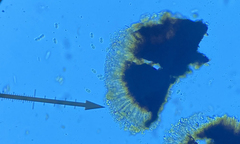 Rhizocarpon hochstetteri