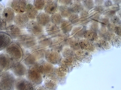 Floscularia