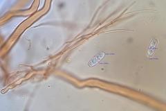 Sarcoscypha vassiljevae