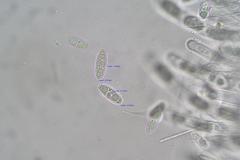 Sarcoscypha vassiljevae