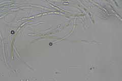 Sarcoscypha vassiljevae