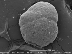 Tiphotrocha comprimata