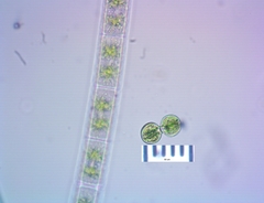 Cosmarium contractum