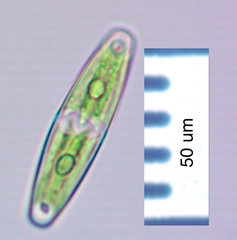 Closterium navicula
