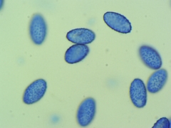 Scutellinia vitreola