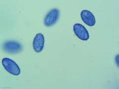 Scutellinia vitreola