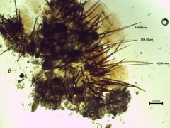 Scutellinia vitreola