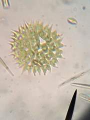 Pediastrum
