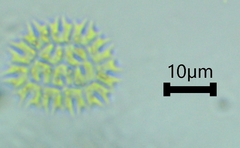 Hydrodictyaceae