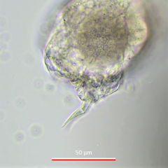 Cephalodella megalocephala