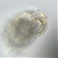 Cephalodella megalocephala