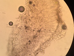Bacidina delicata