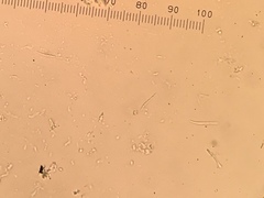 Bacidina delicata