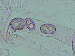 Adelphella babingtonii