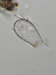 Euglypha acanthophora